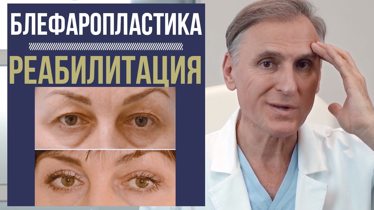 БЛЕФАРОПЛАСТИКА 🔥 РЕАБИЛИТАЦИЯ ВАЖНА ИЛИ НЕТ❓