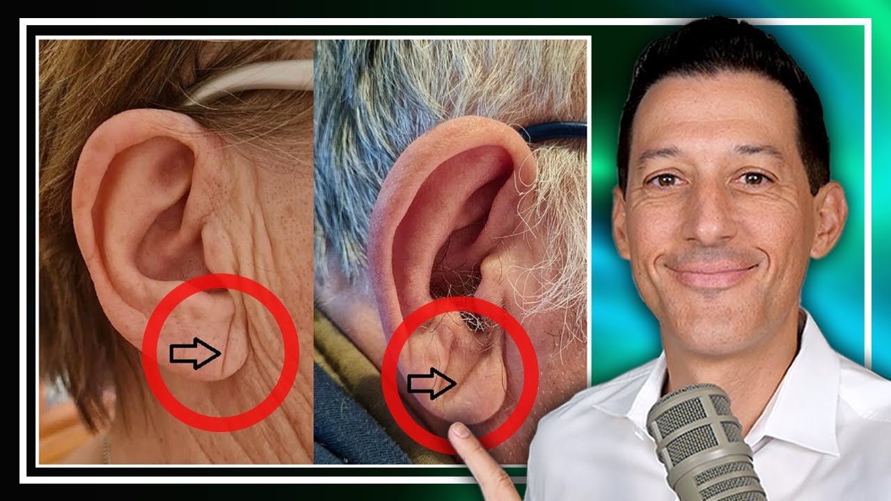 5 Facial Features That Reveal Your Heart Health | Cabral Concept 2679