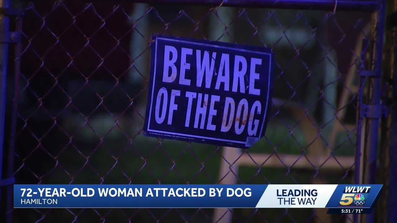 Hamilton woman recovering after violent dog attack