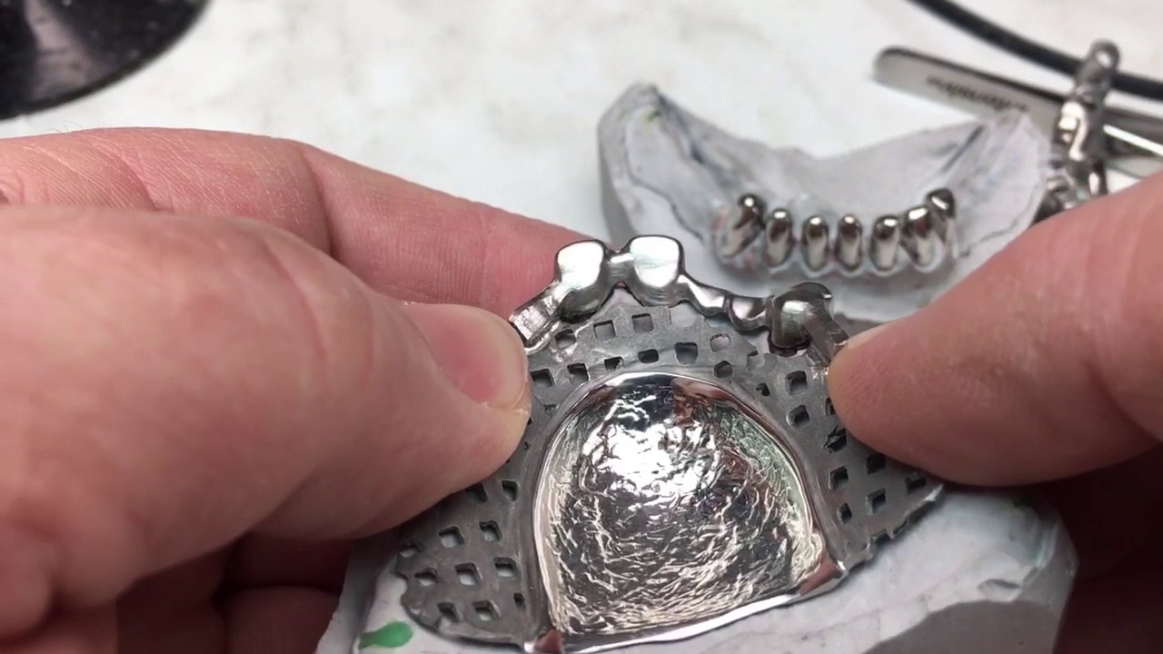 CadCam вторичный каркас телескопного протеза