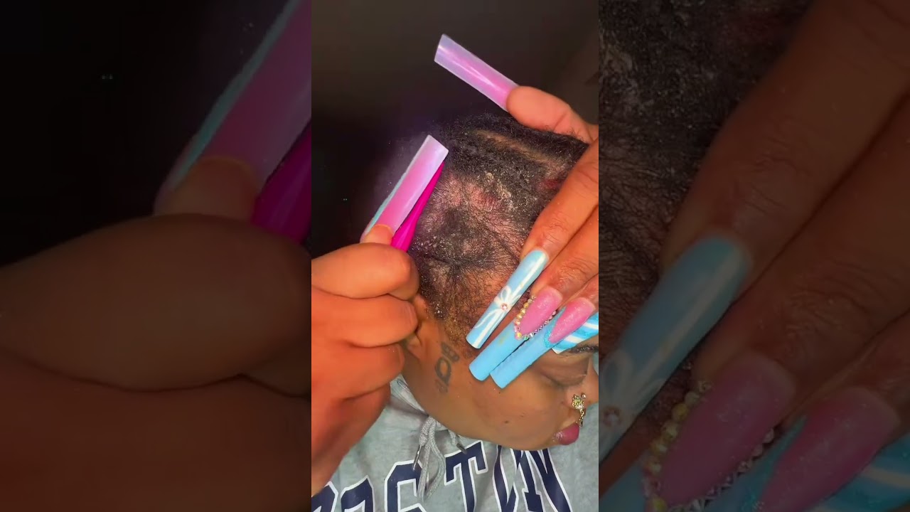 Scratch ASMR 😕😍 #fypシ #scalp #haircare #viral 