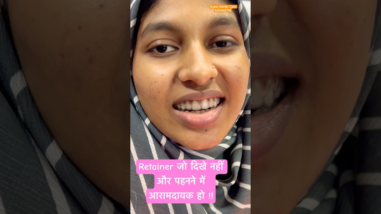 Retainer After Braces 😬 Removal !! #dentist #smile #dentalclinic #trending #dentistry #vivia al a