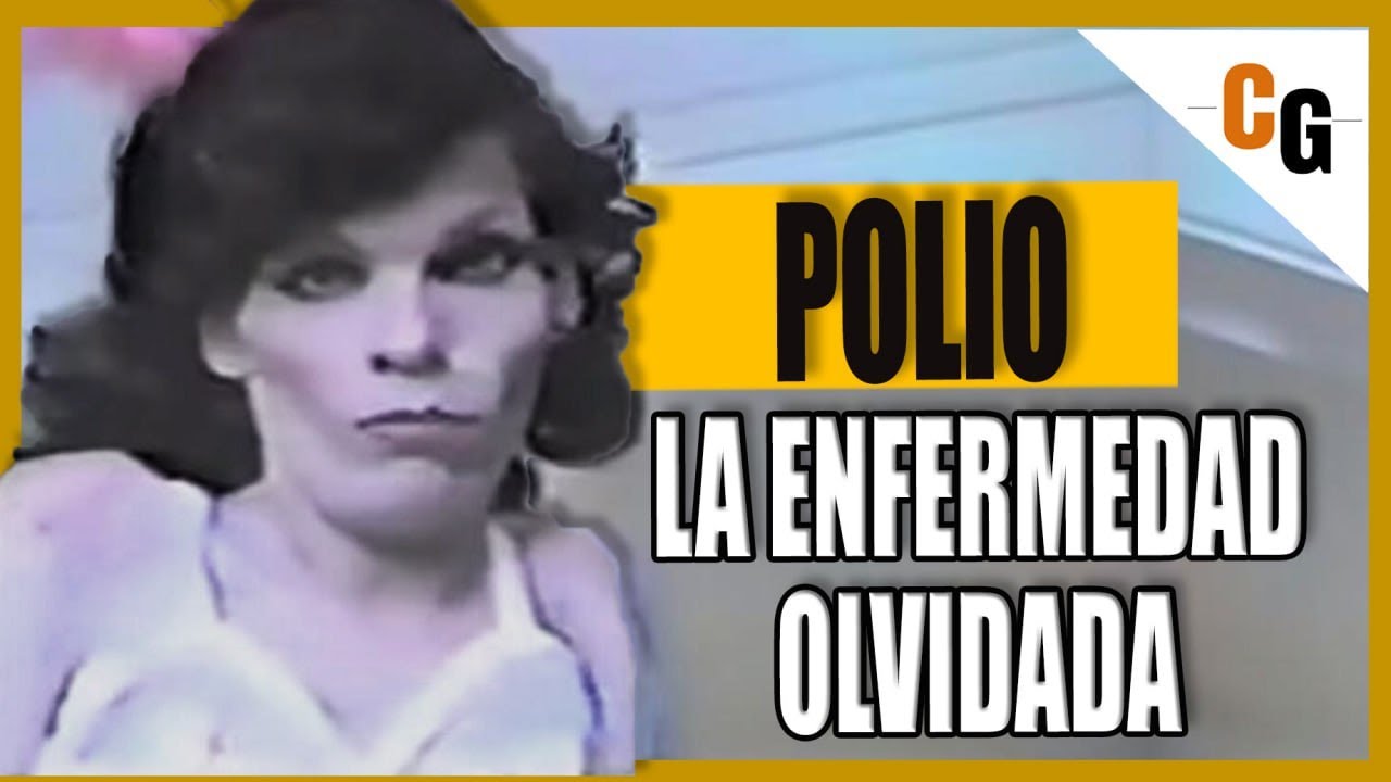 Polio: La Parálisis Contagiosa - Fisiopatología  y Síntomas de la Poliomielitis