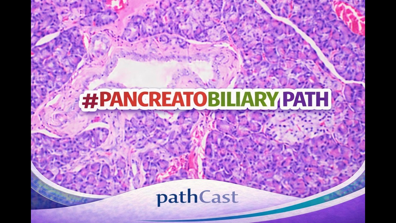 Solid Tumors of the Pancreas - Dr. Basturk (MSKCC) #GIPATH