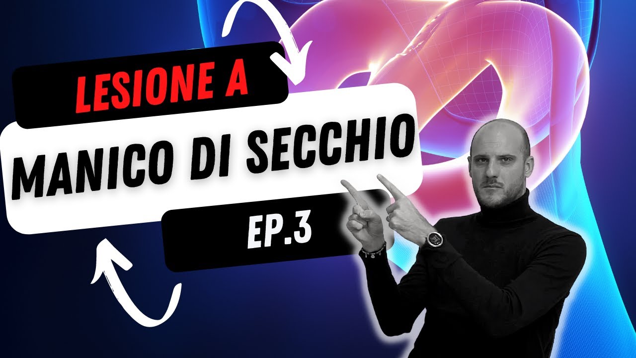 Lesione del menisco a manico di secchio ⚠️ | Diagnosi e trattamento