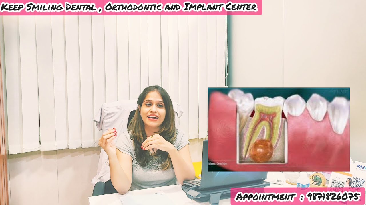 Dental Abscess Types & Treatments | दांत व मसूड़ों में पस बनने के कारण और इलाज | Dr Shikha Malik