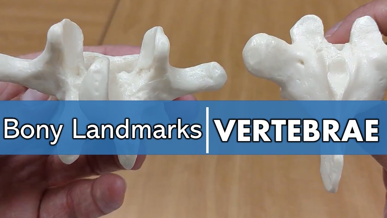Bony Landmarks of the Vertebrae