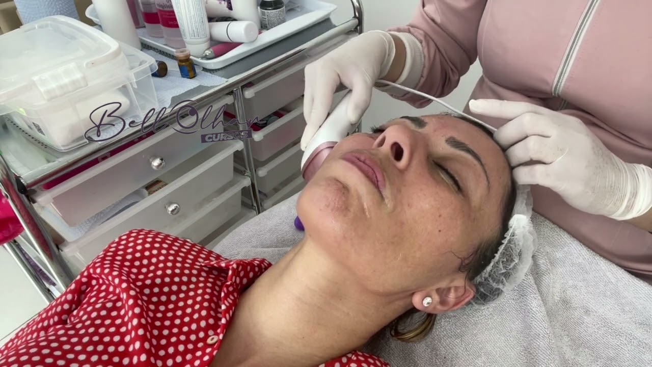 Aula de rejuvenescimento imediato com mini hifu e ácido hialurônico em pó