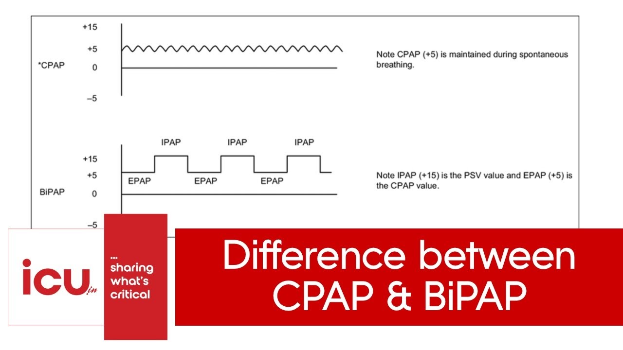 Difference between CPAP and BiPAP | NIV vs CPAP