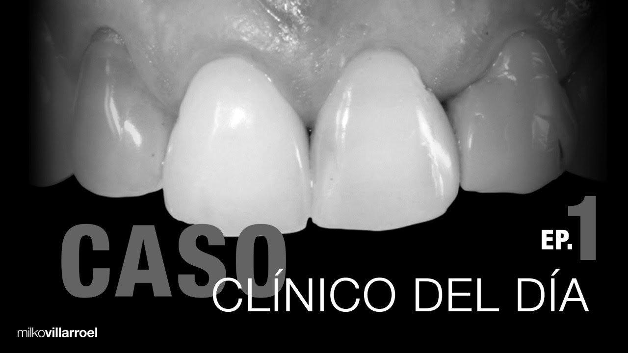 Diferentes sustratos... ¿Cómo solucionar? | #CasoClínicoDelDía | Milko Villarroel