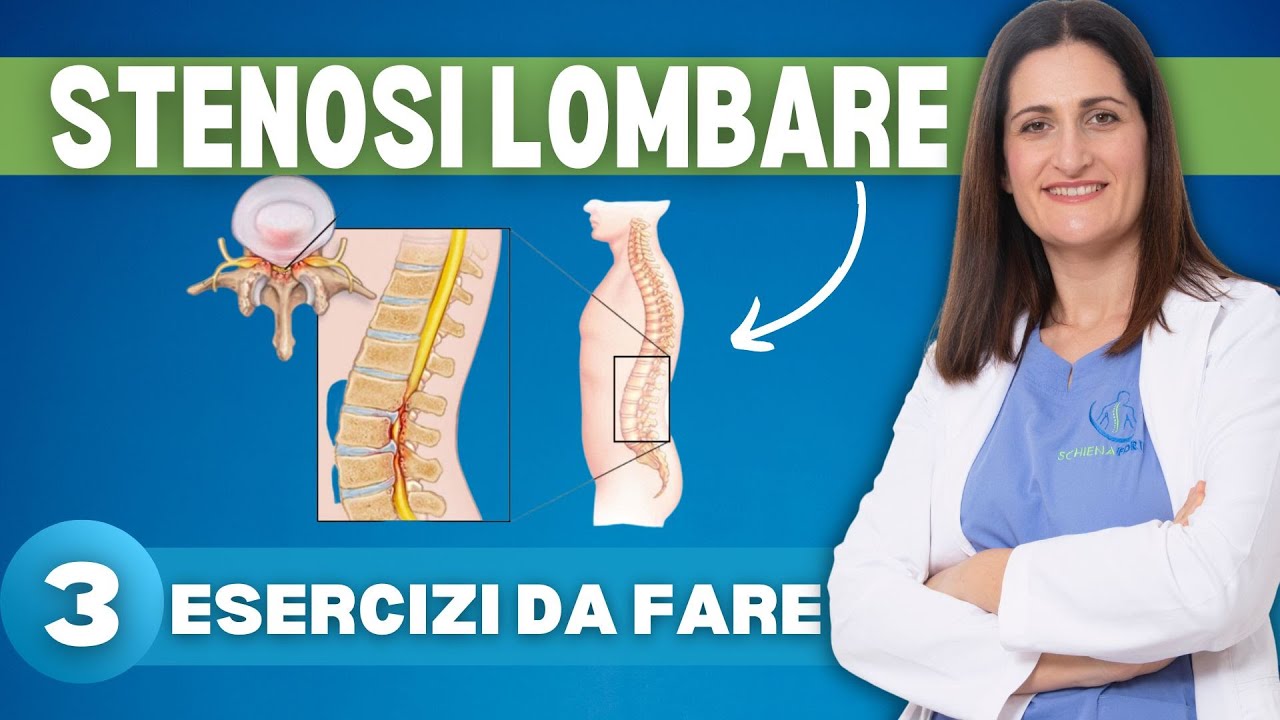 Stenosi Lombare: 3 esercizi efficaci