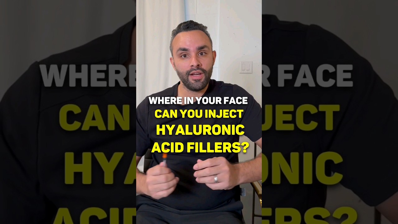 Where can you inject hyaluronic acid fillers in your face?💉💆&zwj;♀️ #hyaluronicacid #fillers #medicalspa
