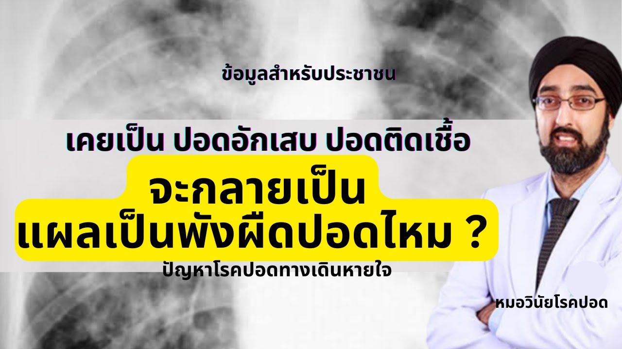 เคยเป็นปอดอักเสบปอดติดเชื้อ จะกลายเป็นแผลเป็นพังผืดปอดไหม | ตอบทุกคำถาม | นพ.วินัย โบเวจา
