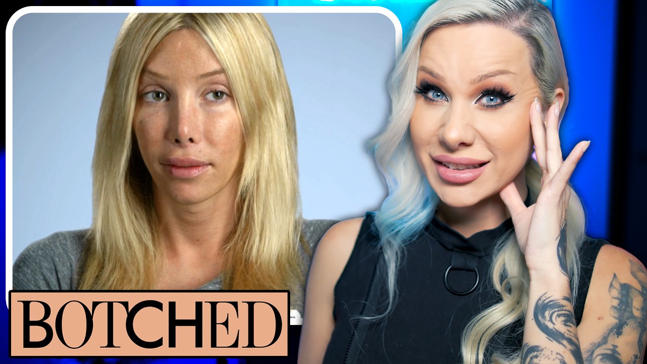BOTCHED! Is 24 trans plastic surgeries too many? volume 3