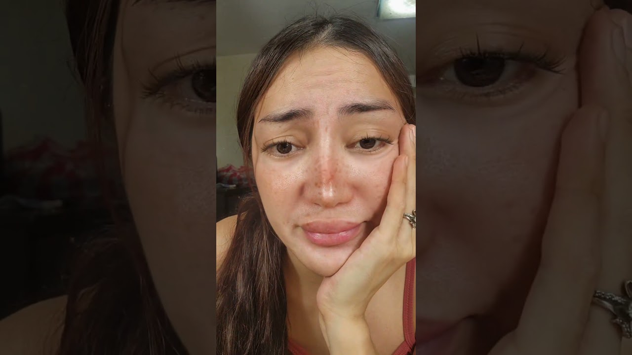 pekas and melasma problem?i SCD PEELING LOTION MONA YAN🤩 #scdArciDyosa #scdpeelinglotion