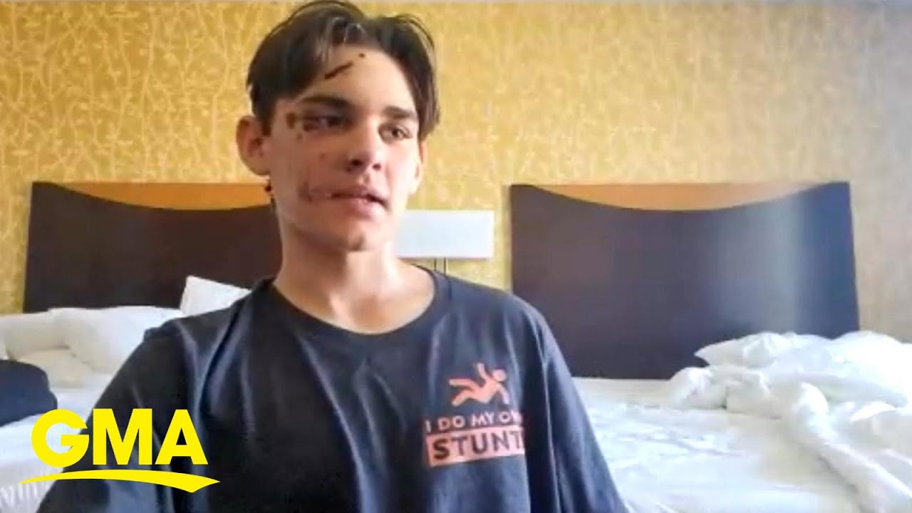 Teen details survival story after falling nearly 100 feet into Grand Canyon l GMA