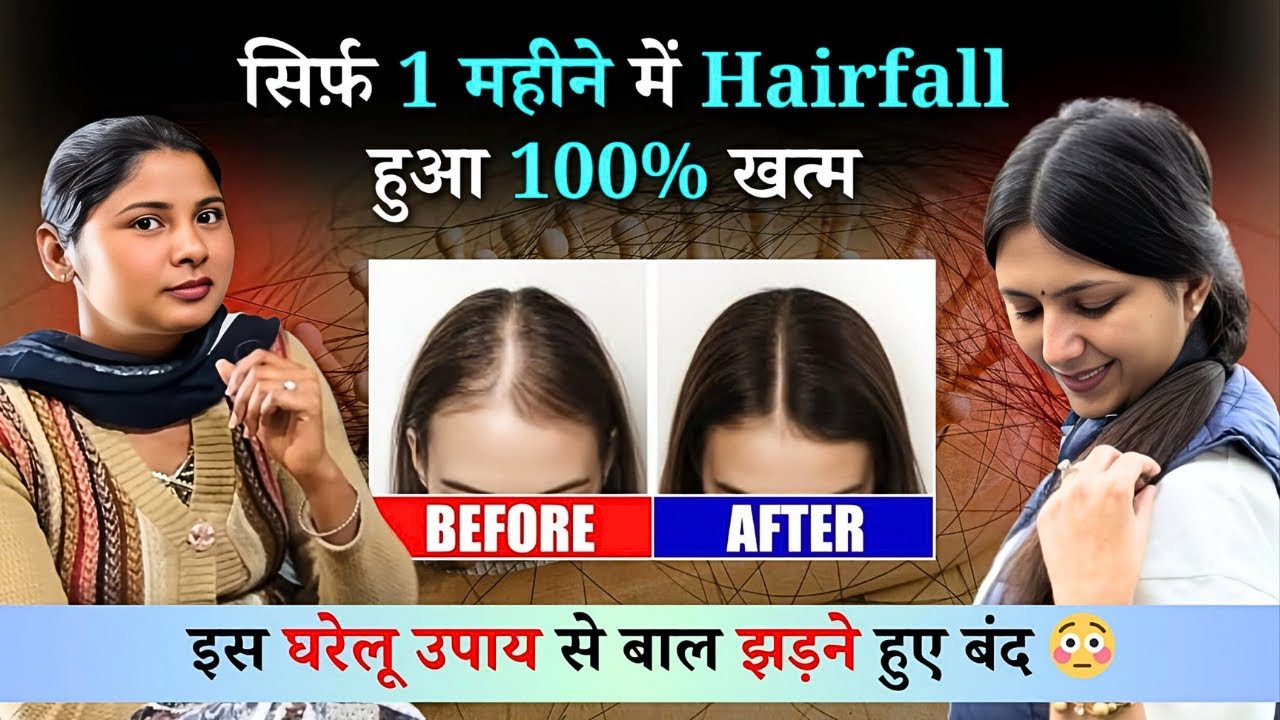 Hairfall को कैसे रोकें | How to Stop Hairfall Permanently | Haircare Routine | Dr. Upasana Vohra