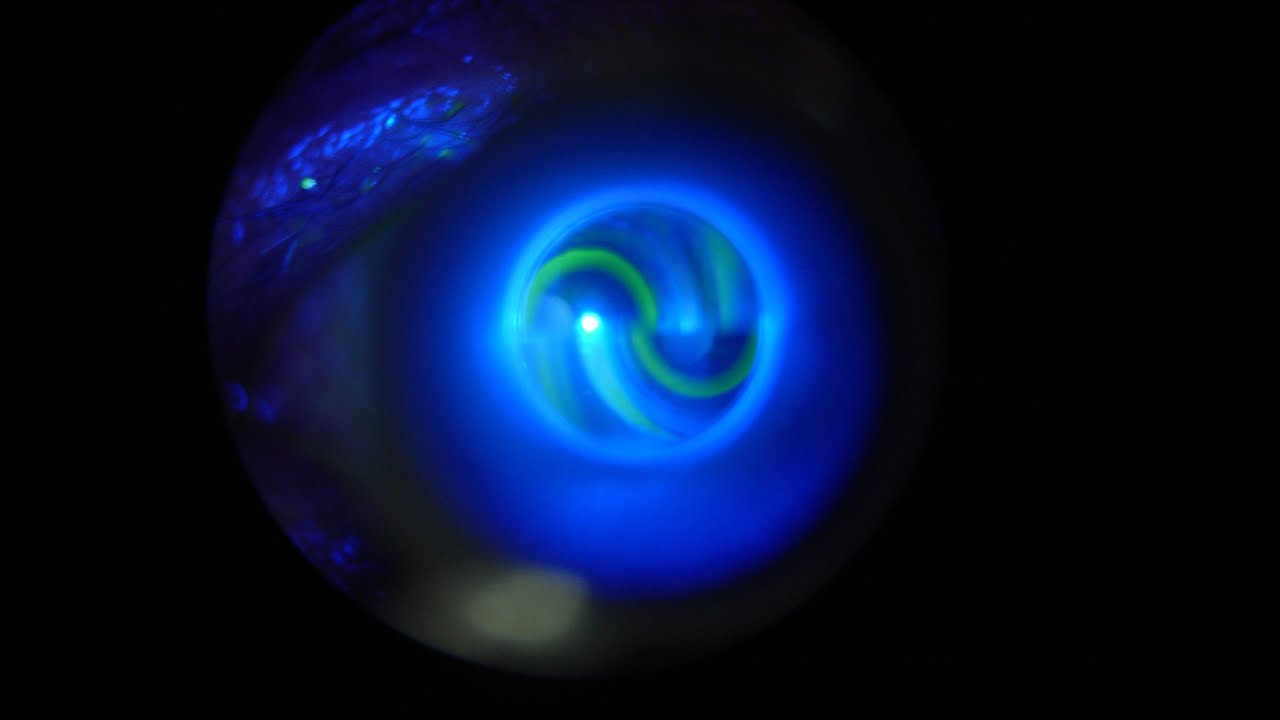 intraocular pressure (IOP)