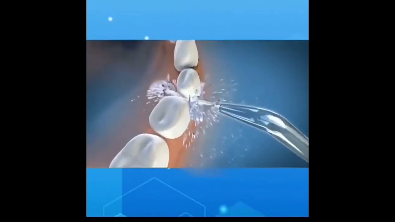 Cordless Water Flosser 200ml with 4 Replaceable Heads 11291 JETFLOSS EOKK