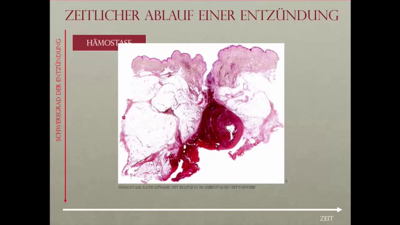 Das macht dein Gewebe bei der Wundheilung- von der Wunde bis zur Narbe | Dr. Alawi