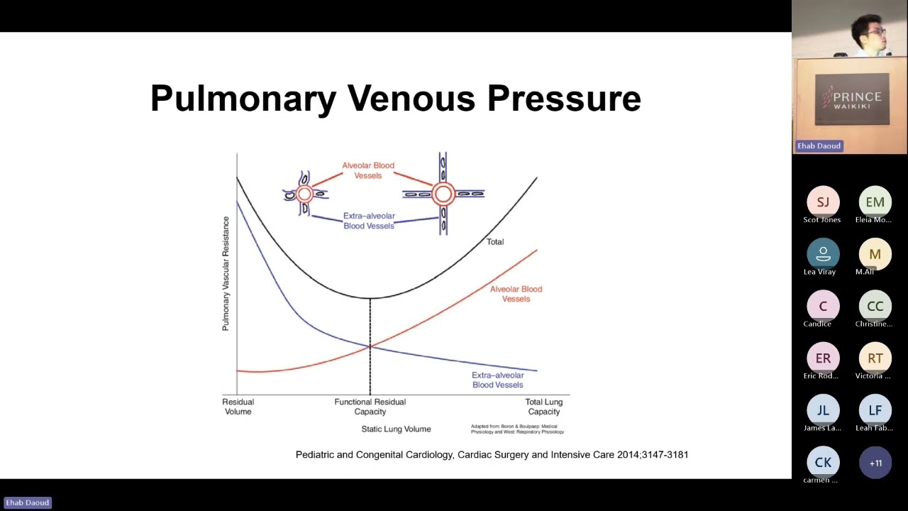 Heart Lung Interaction  Dr Ryota Sato. Society of Mechanical Ventilation Conference 2023.