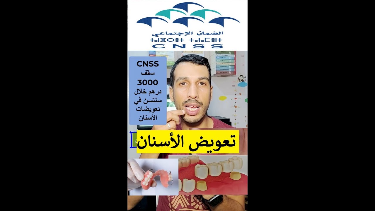 CNSS AMO تعويض علاج الأسنان الضمان الاجتماعي امو تضامن امو الشامل سقف 3000 درهم سنتين