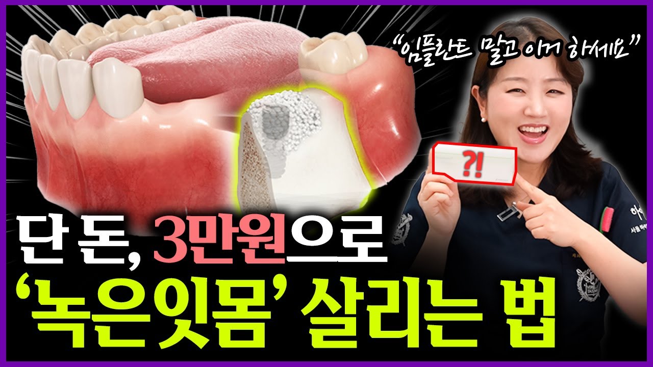 임플란트 하지마세요! '3만원'으로 내려간 잇몸뼈 재생시키는 잇몸약 알려드릴게요!