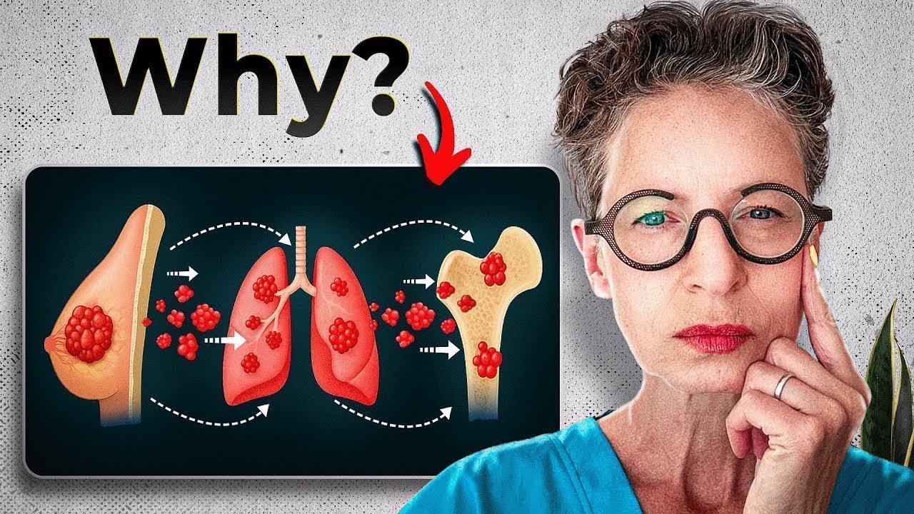 After Treatment: Why Breast Cancer Still Comes Back