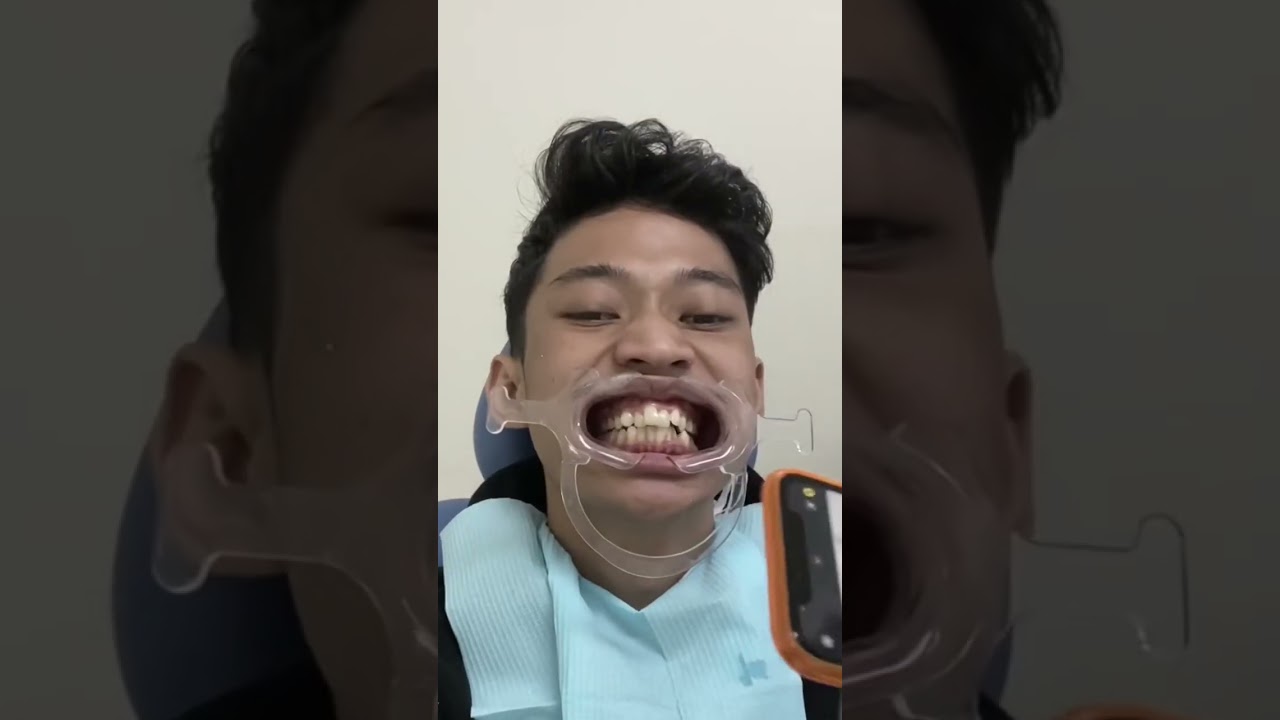 PASANG BEHEL BIAR RAPI AHMAD #challenge
