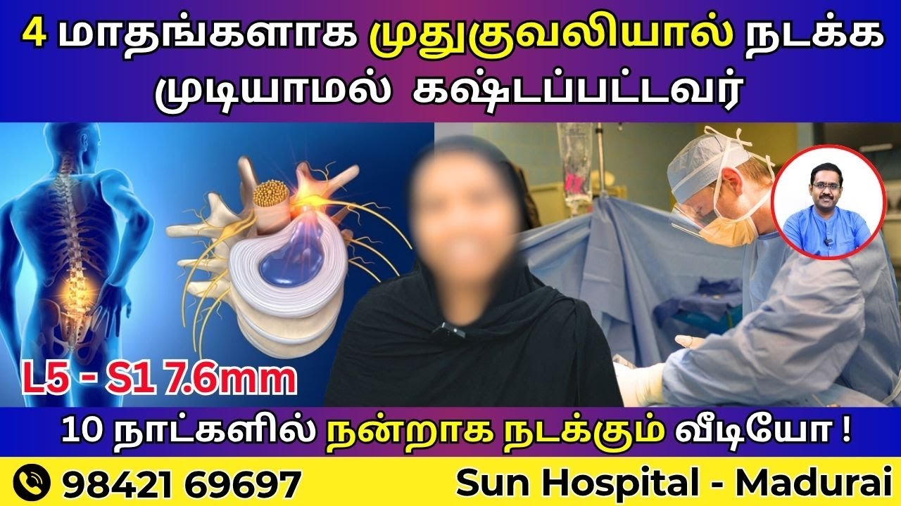 4 மாதங்களாக முதுகுவலியால் நடக்க முடியாமல் |கஷ்டப்பட்டவர்  10 நாட்களில் நன்றாக நடக்கும் வீடியோ !