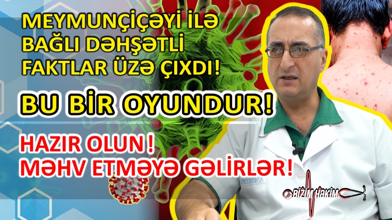 Həkim meymunçiçəyi ilə bağlı elə şeylərin üstünü açdı ki.. - MƏQSƏDLƏRİ HAMINI MƏHV ETMƏKDİR! #viral