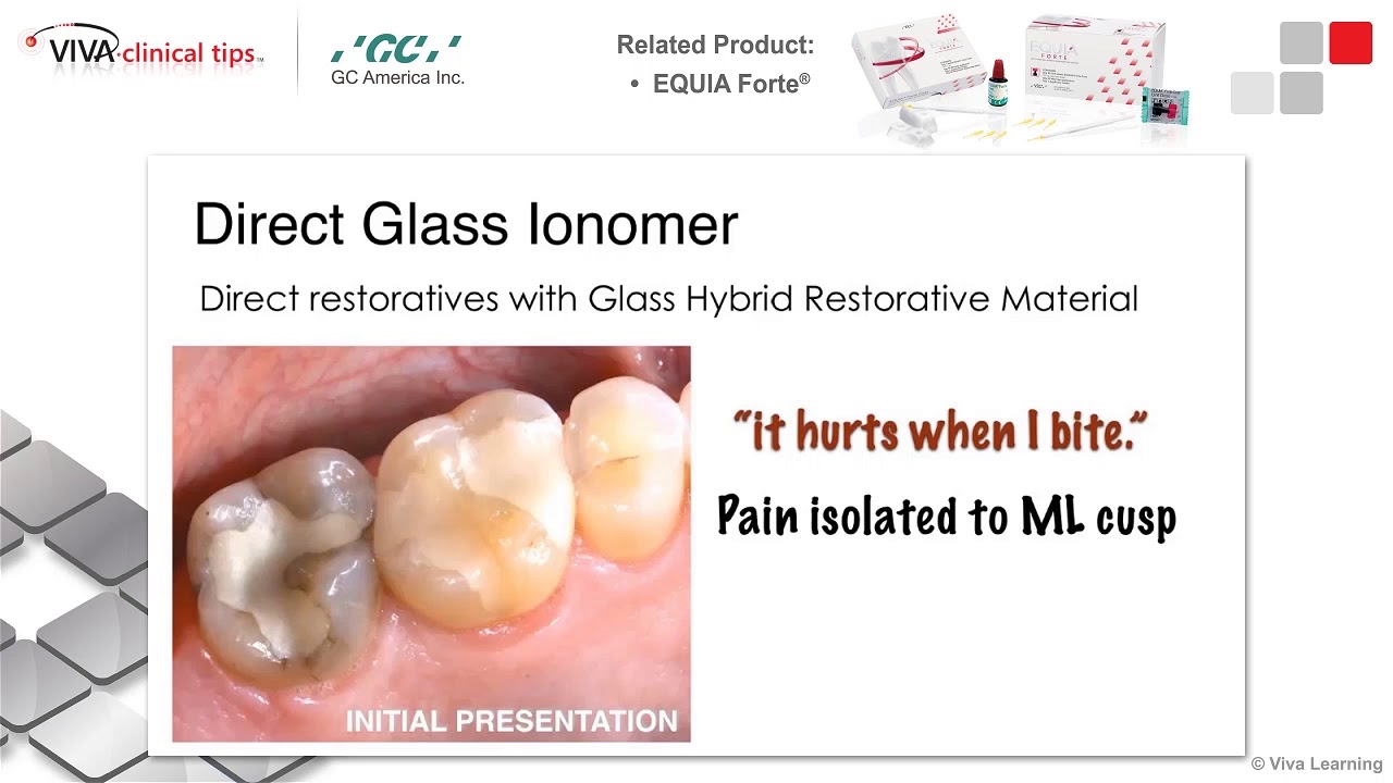 Dr. Maragliano-Muniz on EQUIA Forte