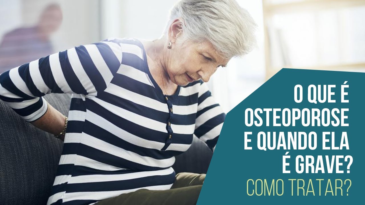 O que é osteoporose e quando ela é grave? Como tratar?