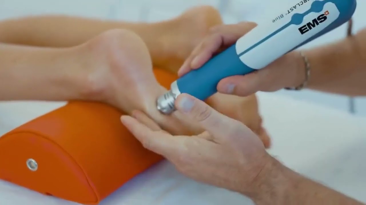 How to use Radial Shock Waves on the feet