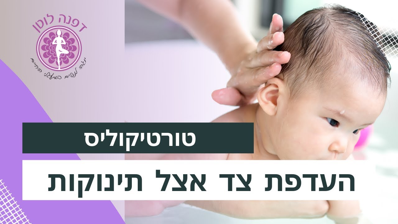 העדפת צד אצל תינוקות- טורטיקוליס