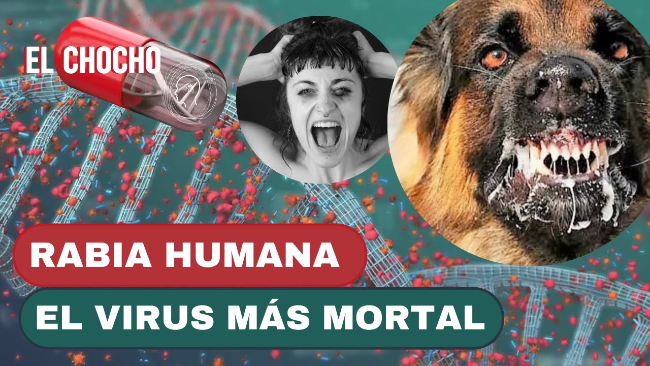 Rabia humana: El virus más mortal | El chocho  #adn40radio