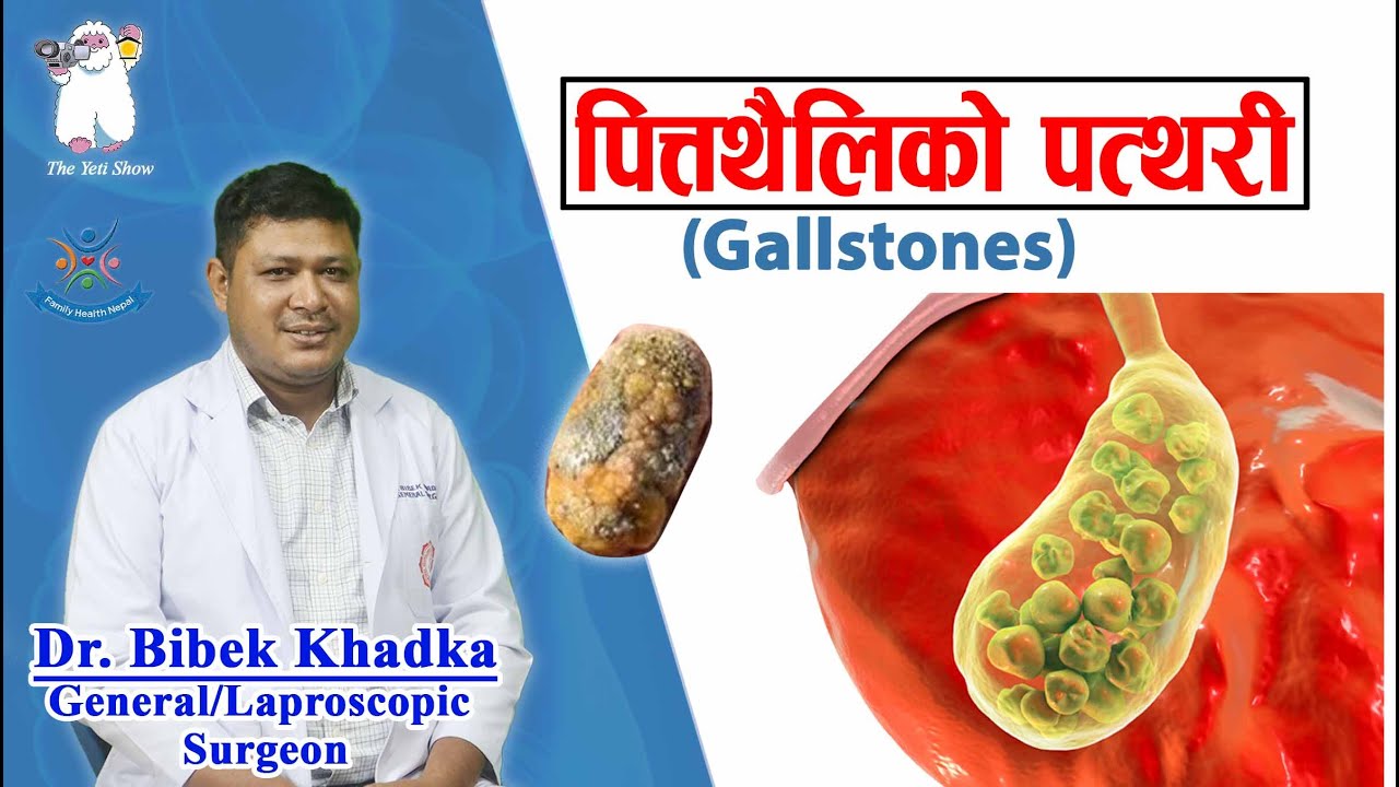Gallstones (पित्त थैलिको पत्थरी ) Dr. Bibek Khadka (Annapurna Neuro  Hospital )