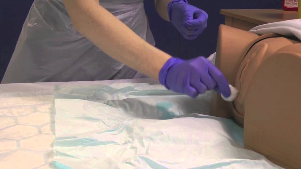 Female Catheterisation - Procedure Only