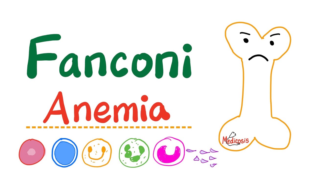 Fanconi Anemia - Mnemonic - Pancytopenia - Bone Marrow Disease - Hematology, Pathology