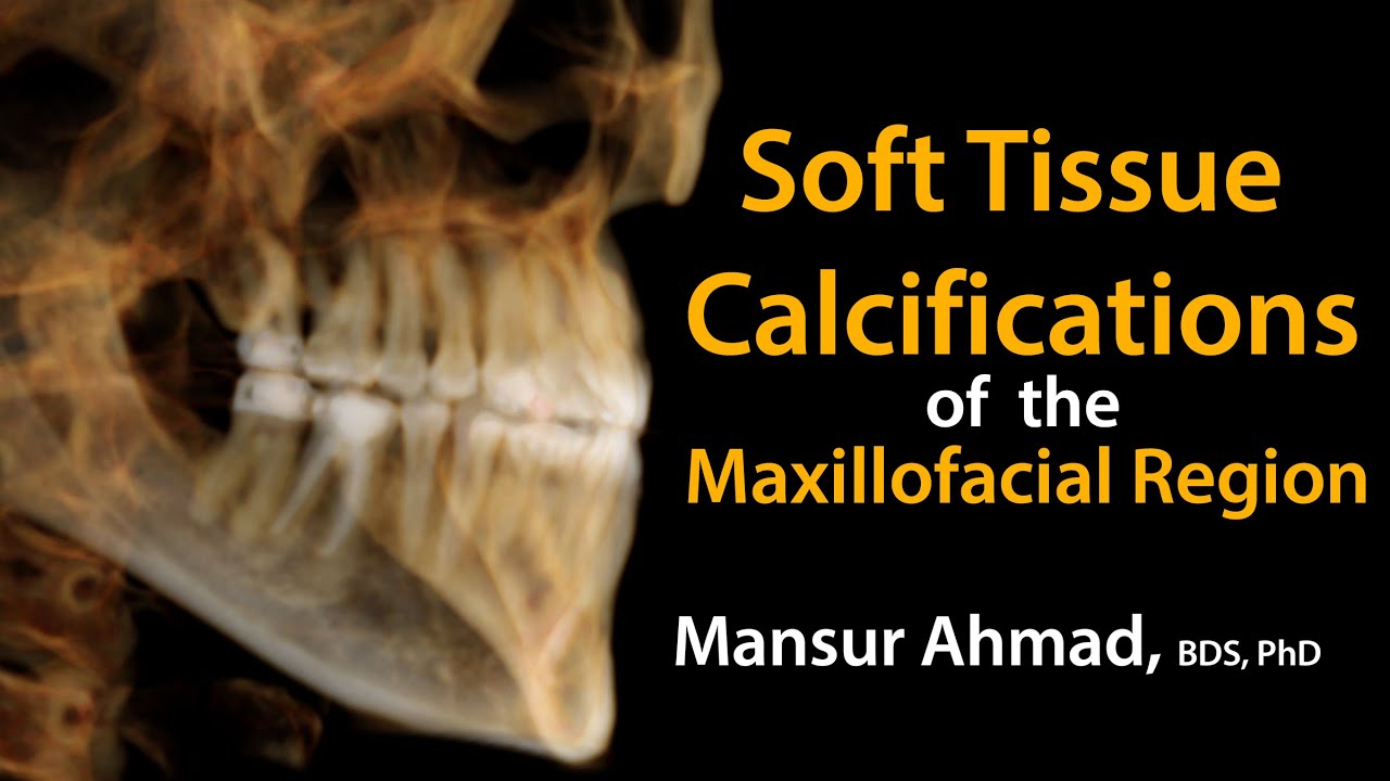 Soft Tissue Calcifications of the Maxillofacial Region