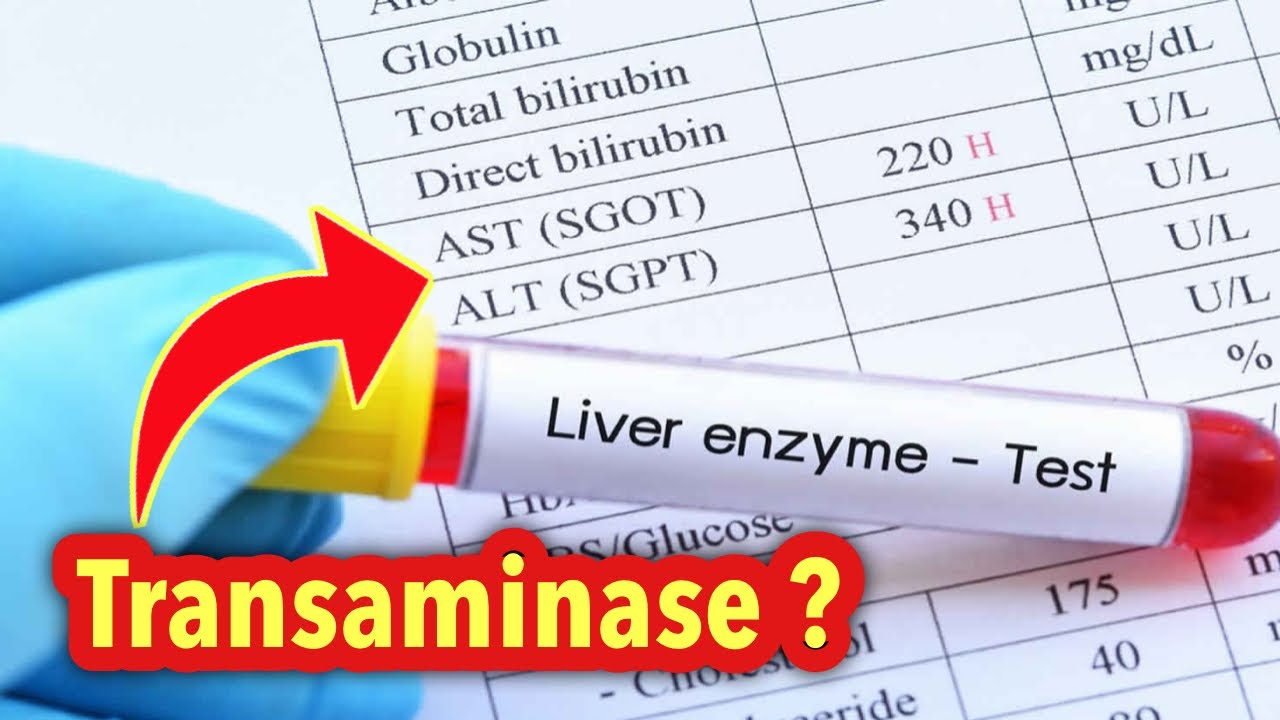 តើគេមើល Transaminase ក្នុងគោលបំណងអ្វី? | រៀនបកប្រែលទ្ធផលឈាមទាំងអស់គ្នា!
