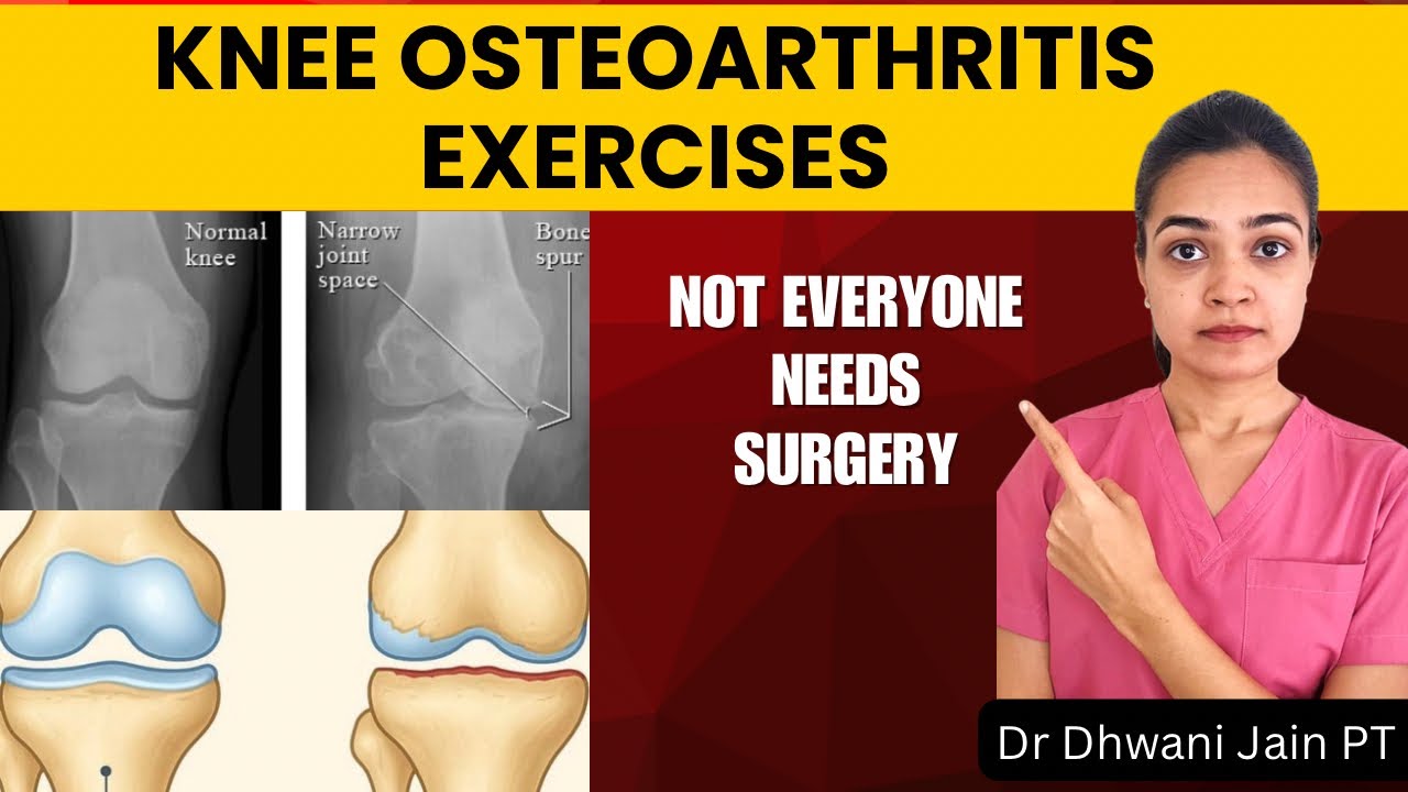 Knee Osteoarthritis Explained | Best Exercises for Knee | Dr Dhwani Jain PT