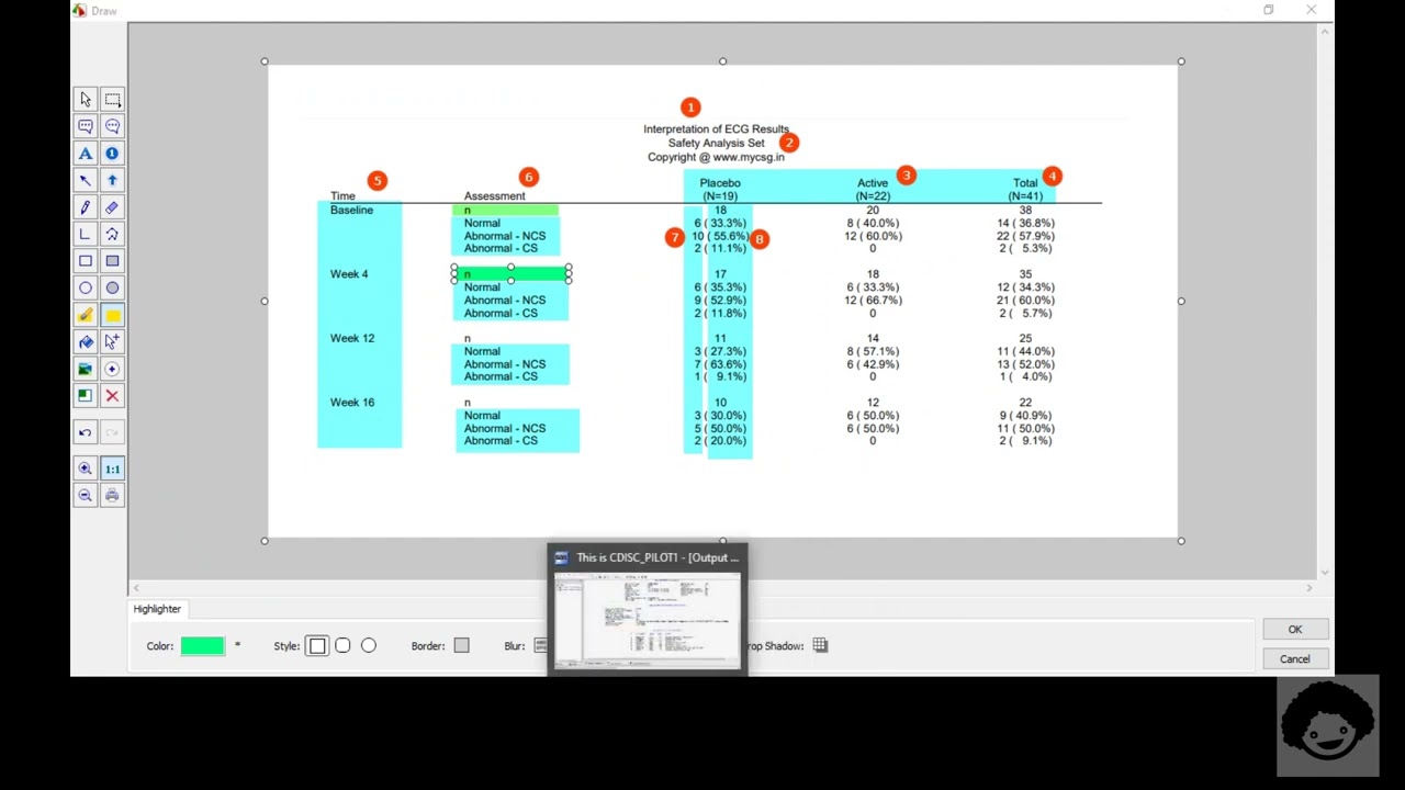 TFL TEG L101 - Interpretation of ECG results - Live coding