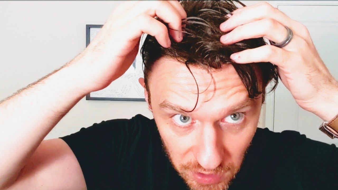 HAIR SYSTEM | LIGHT DENSITY VS MEDIUM DENSITY PART 2 | DIRECT COMPARISON | MEN'S HAIR REPLACEMENT