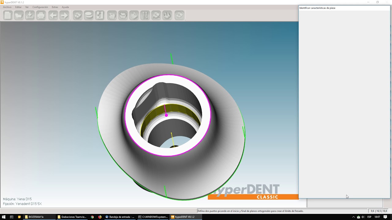 HYPERDENT - 5 - Interfase sin metadatos