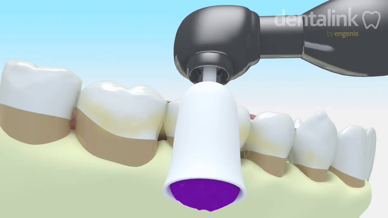 &iquest;C&oacute;mo es el procedimiento para la periodoncia? - Cl&iacute;nica Dental Vicich