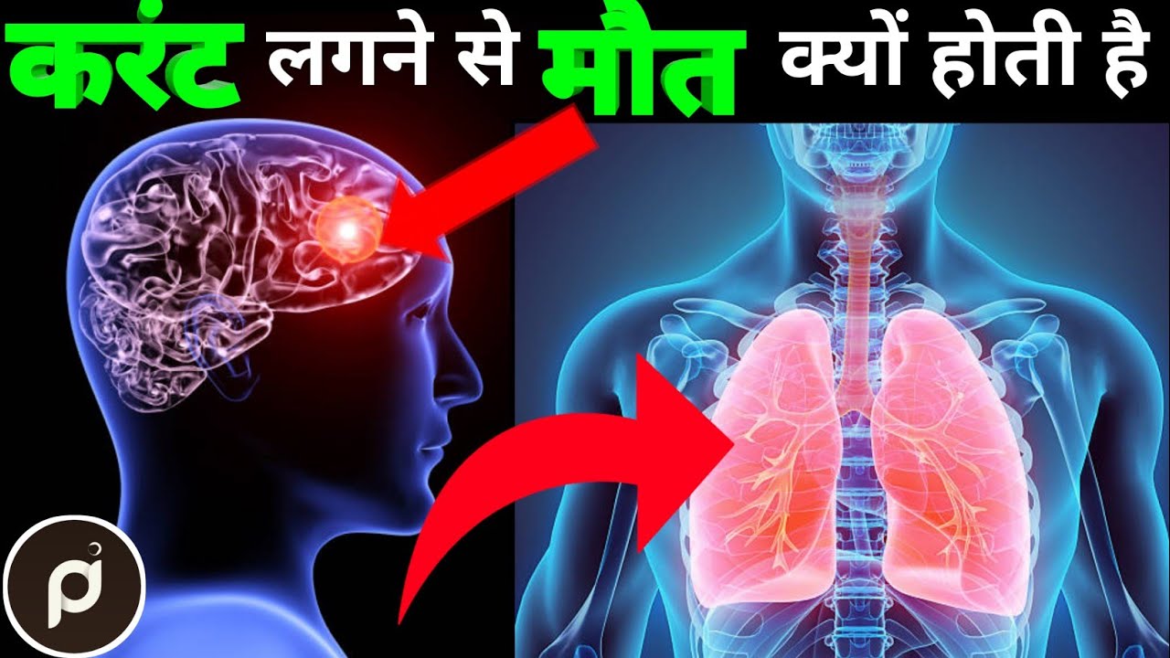 Why does a person die from an electric shock? || How a person dies from electric shock | Shock