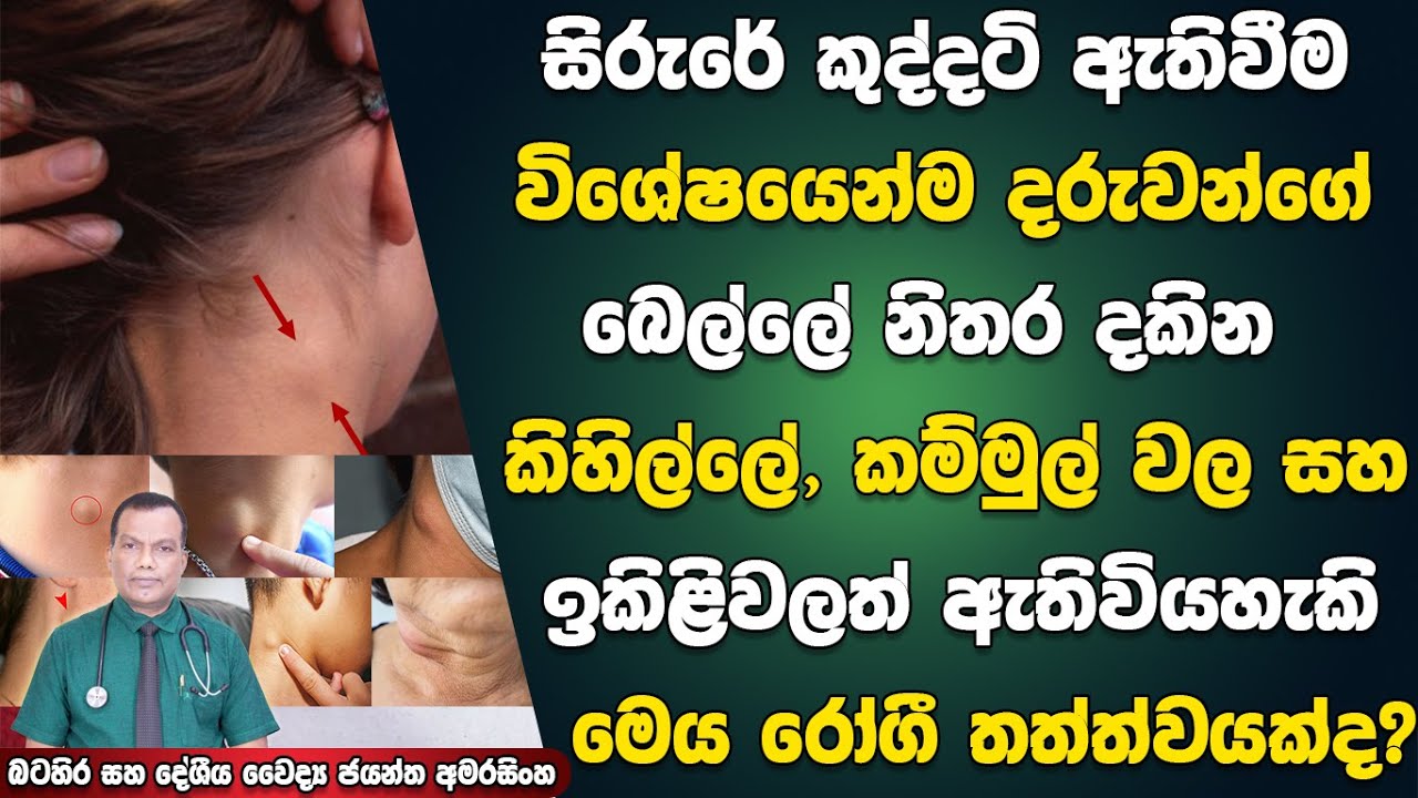 සිරුරේ කුද්දටි ඇතිවීම, විශේෂයෙන්ම දරුවන් ගේ බෙල්ලේ නිතර දකින කුද්දටි තත්ත්වය රෝගී තත්ත්වයක්ද?