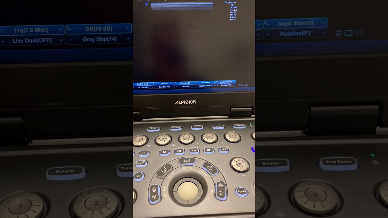Alpinion i7 - how to activate harmonic imaging