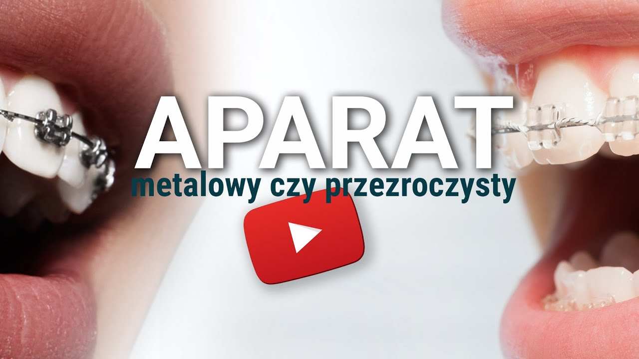 Aparaty metalowy czy przezroczysty - Ortodoncja Fudalej